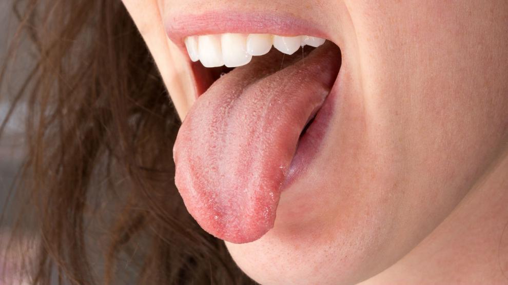 Por qu debo limpiar mi lengua? - Foto